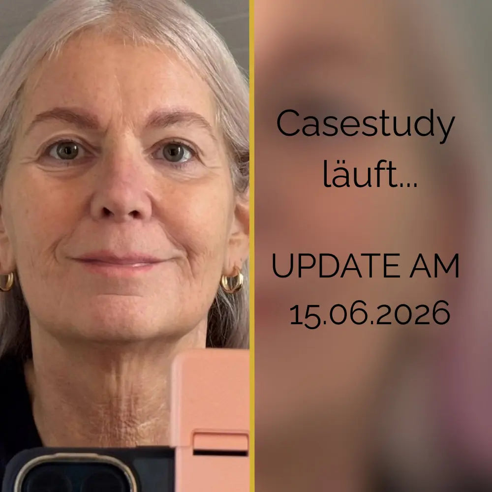 CaseStudy Referenzkundin Hyluna 3R-Methode 