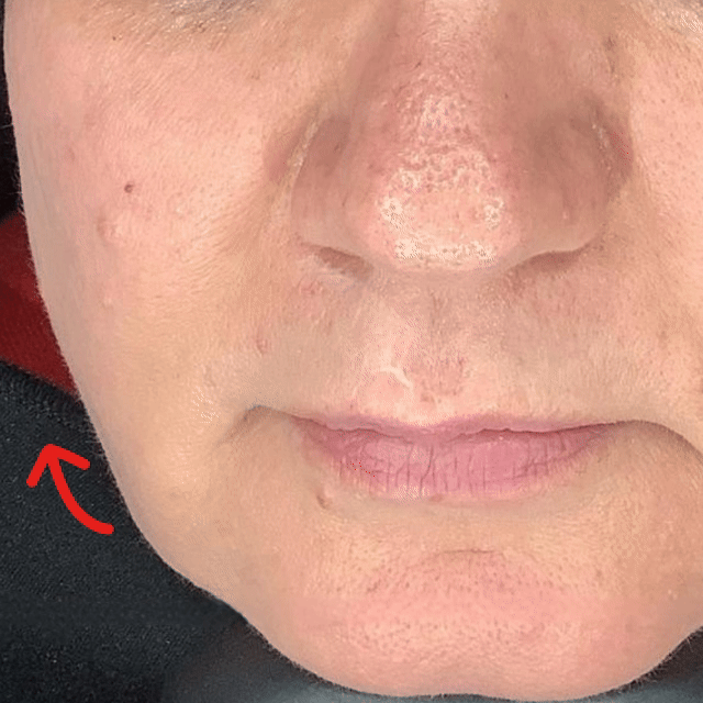 Anti-Ox Booster Mask - Hyluna