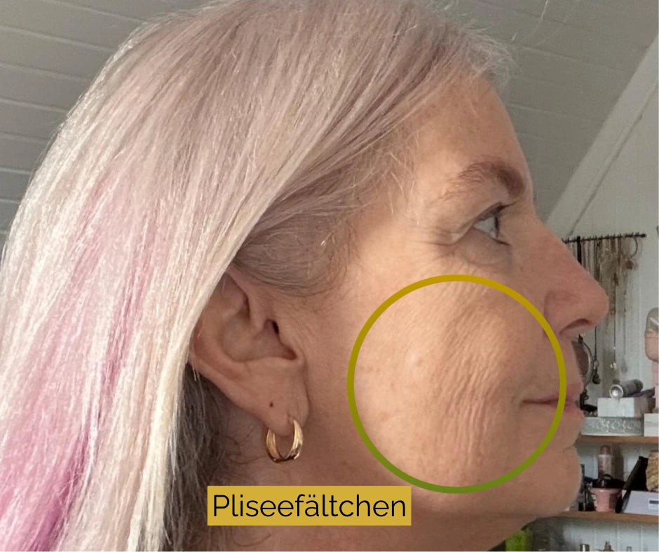 trockene schuppige haut im gesicht erfahrungsbericht petra 57 pliseefältchen